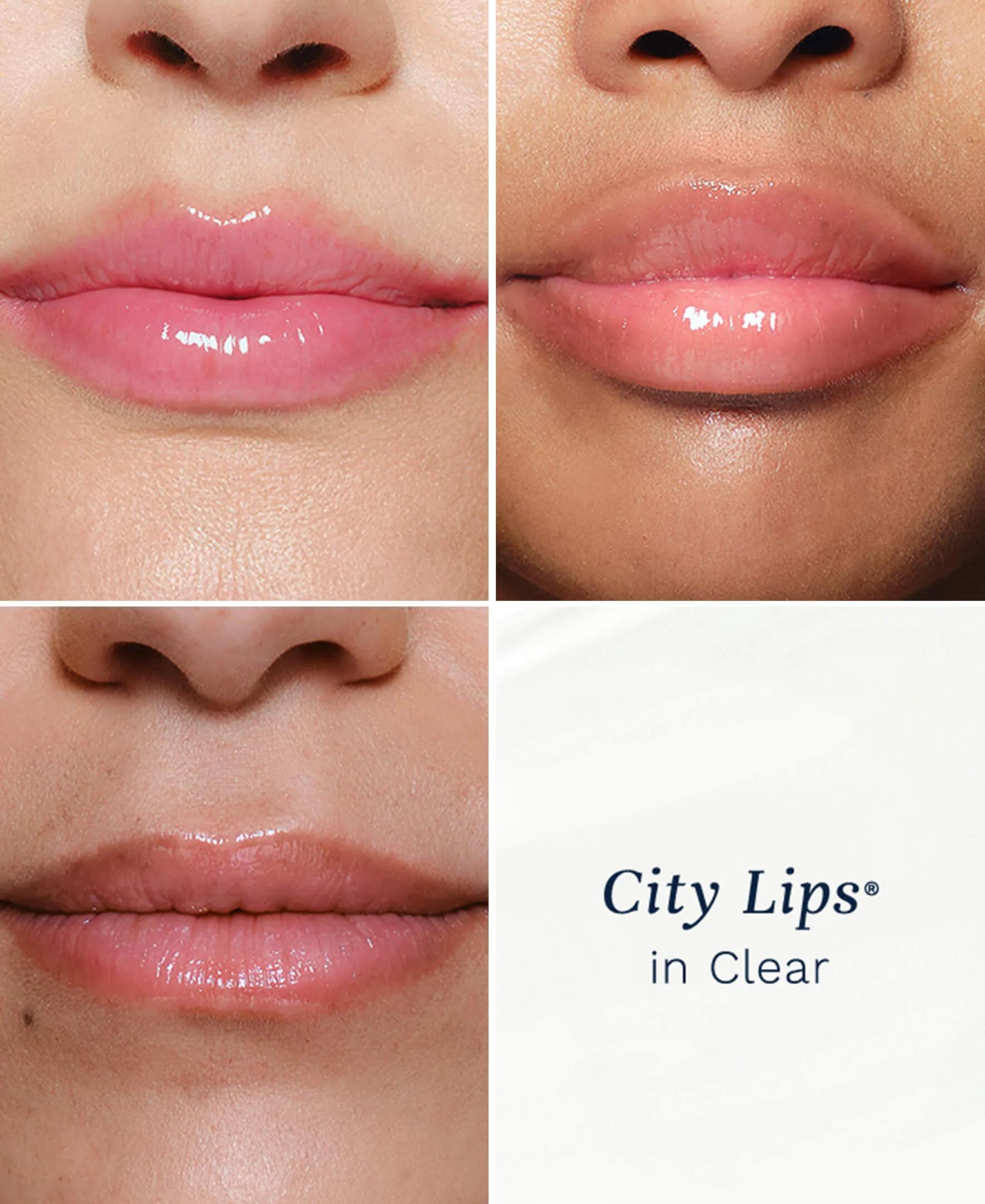 City Lips® - Image 3